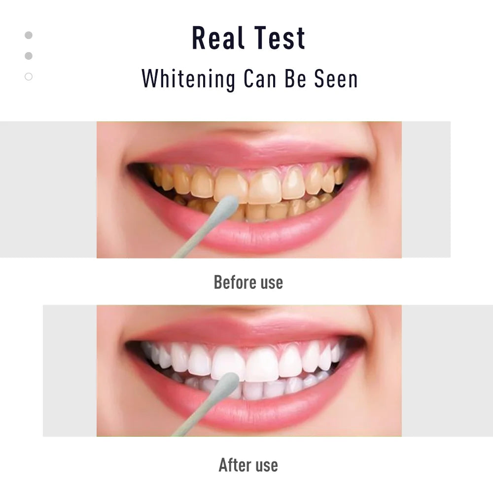 Gel dental para blanquear los dientes